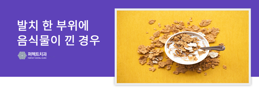 발치 후 무엇을 먹어야 잘 먹었다고 소문날까? 관련 이미지 2