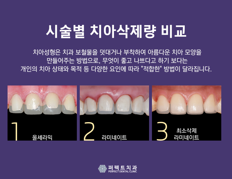앞니 올세라믹 중요한 정보는? 관련 이미지 1