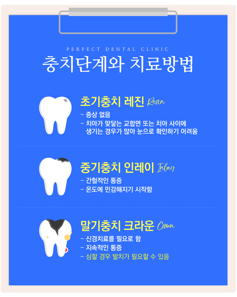 충치치료 레진가격! 관련 이미지 5