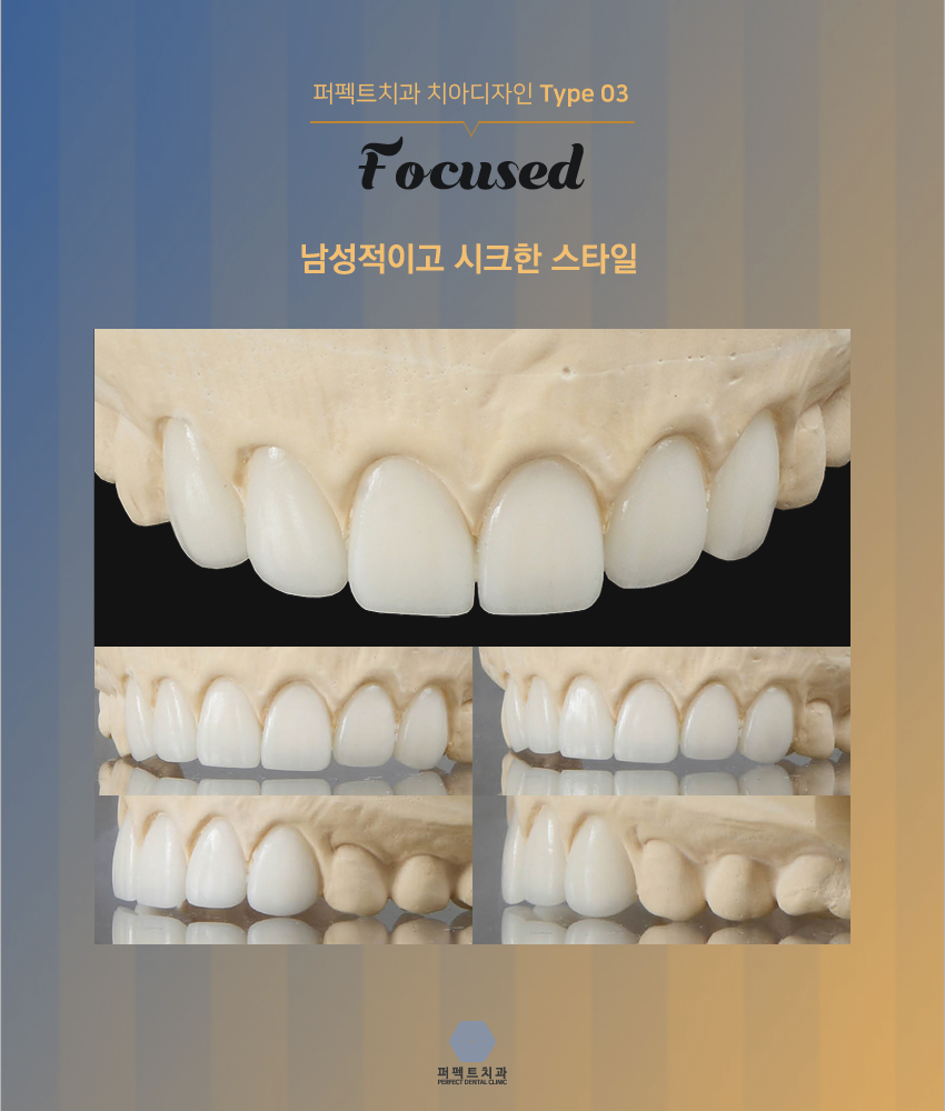 올세라믹크라운 저렴한곳! 관련 이미지 6