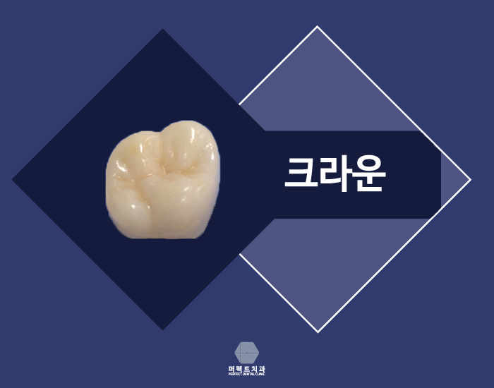 상실한 치아 찾고 싶은데 보철치료 종류에는? 관련 이미지 2