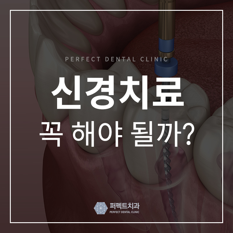 신경치료가 필요한 경우 / 통증,과정,크라운 관련 이미지 1