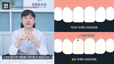 앞니 라미네이트 가격과 두께의 진실 관련 이미지 5