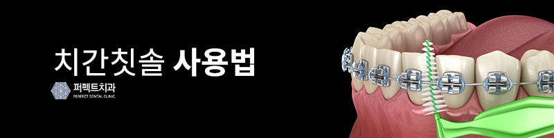 치간칫솔 사용법 제대로 알고 쓰자! 관련 이미지 2