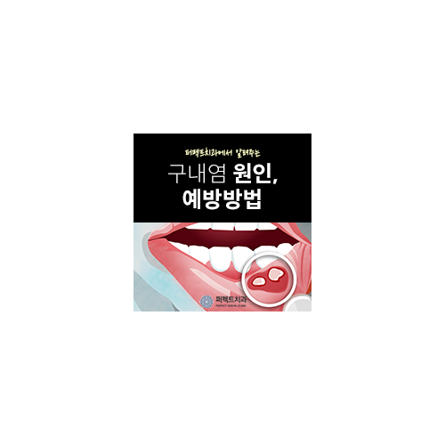 유아 구내염 원인, 치료법 관련 이미지 6