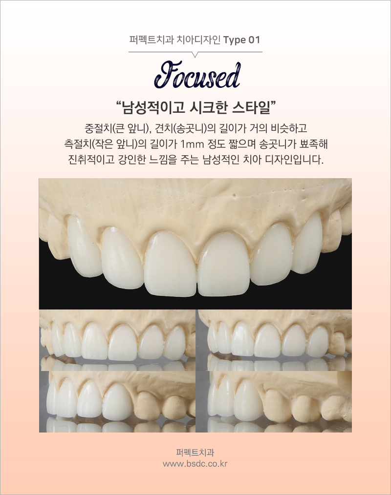 앞니성형 믿고 할 수 있는 치과! 관련 이미지 4