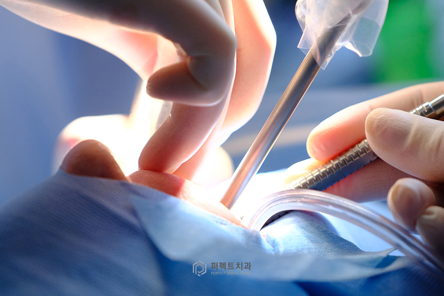 임플란트 병원을 선택할 때 주의할 점은? 관련 이미지 3