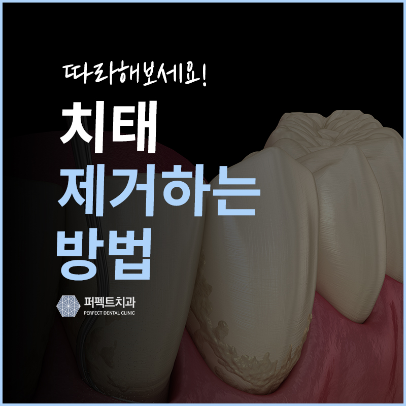 혼자서 치태 없애는 방법! 관련 이미지 1