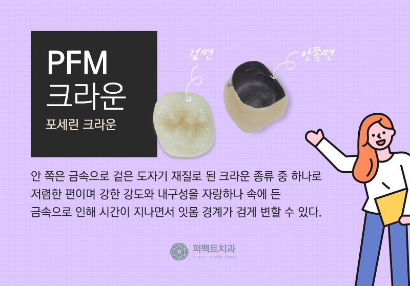 선릉역 어금니 지르코니아 가격 관련 이미지 4