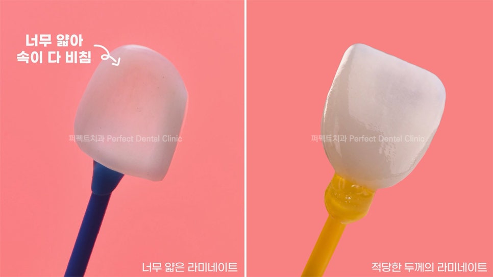 라미네이트 얇을수록 좋은가요? 관련 이미지 5