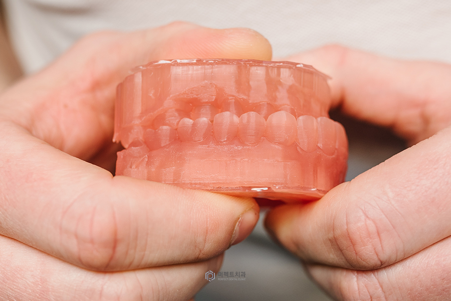 #3탄_의료보험 적용되는 치과치료는?(임플란트편) 관련 이미지 3