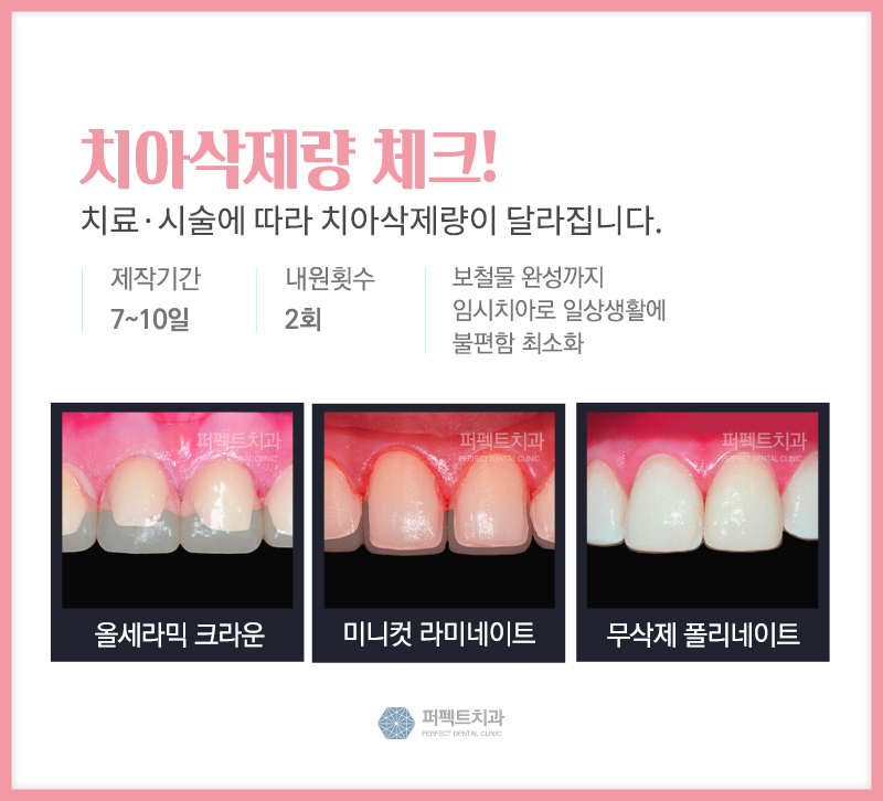 앞니라미네이트 퍼펙트한 비용 확인하기! 관련 이미지 2