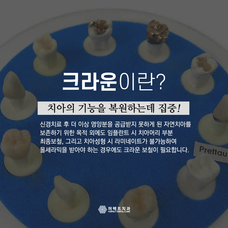 5월 프로모션 진행중인 ▶ 지르코니아 크라운! 관련 이미지 1