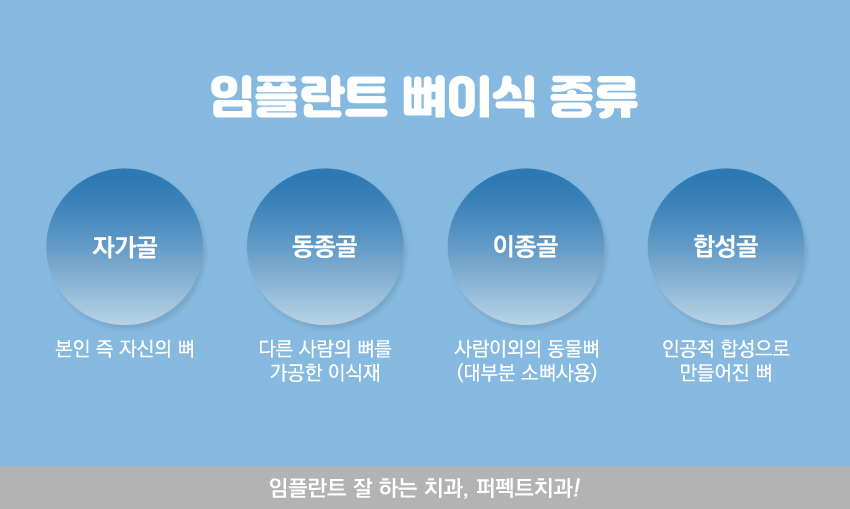 임플란트뼈이식 필요한 사람들에게~ 관련 이미지 3