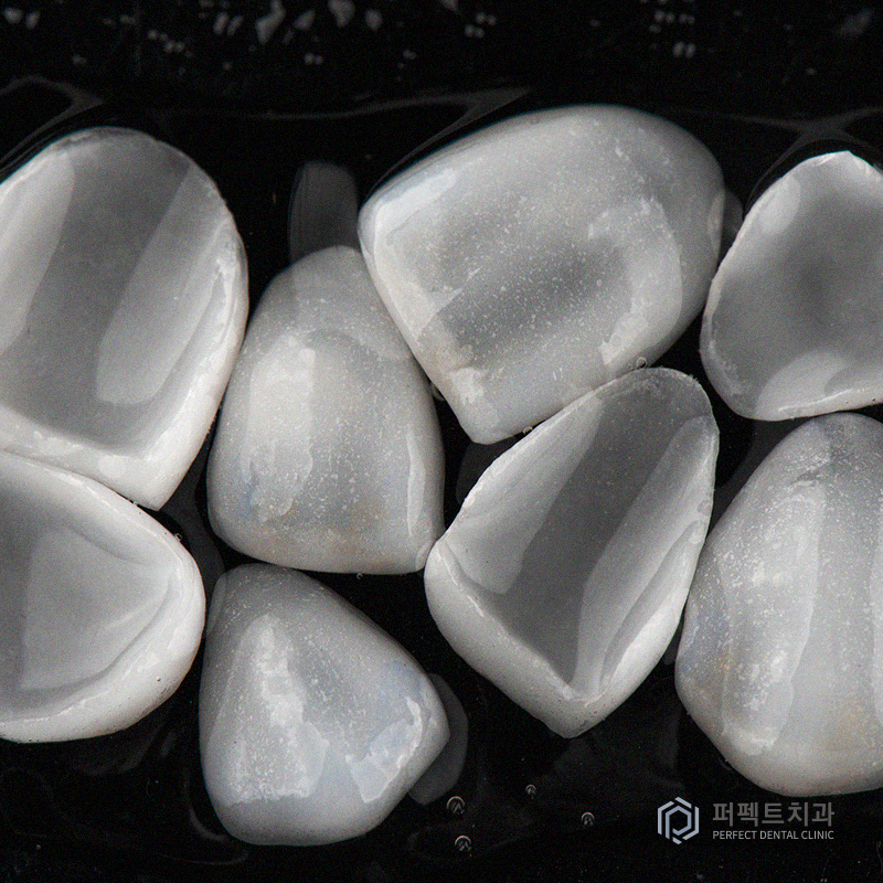 무삭제라미네이트의 솔.직.한 장단점! 관련 이미지 3