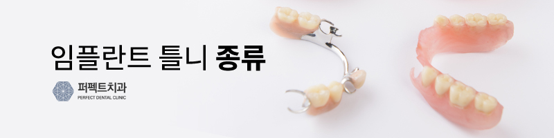 임플란트틀니 뭐가 다른가요? 관련 이미지 4
