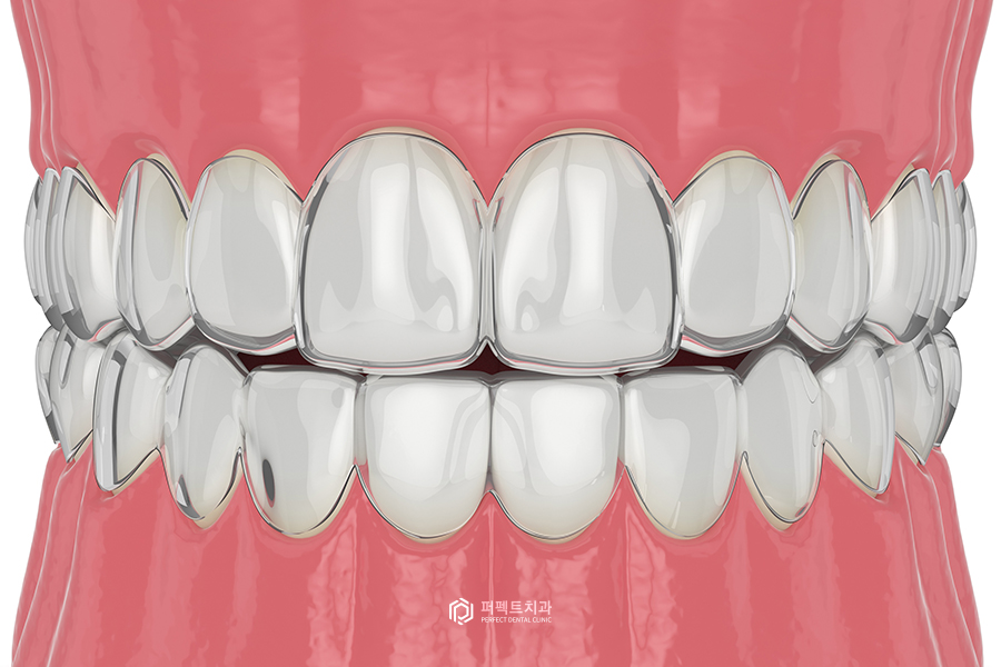 치료해도 자꾸 벌어지는 치아..😨 원인은? 관련 이미지 6