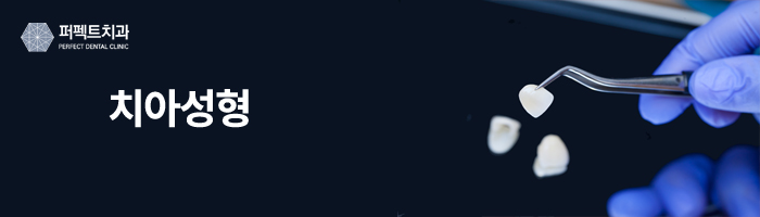 치아교정과 치아성형, 다른 점이 뭘까? 관련 이미지 3