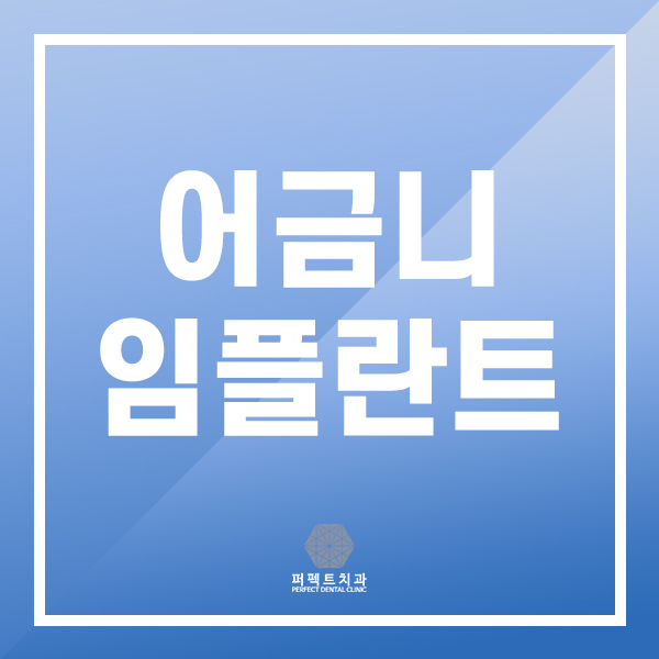 어금니 임플란트 부작용 증상 관련 이미지 1