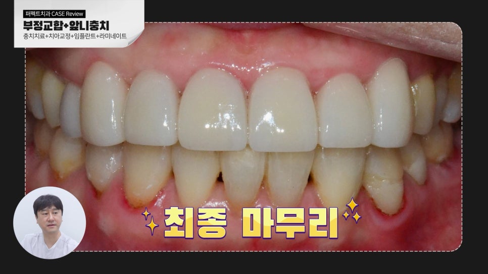 복합적인 치료가 필요한 케이스 리뷰 관련 이미지 8