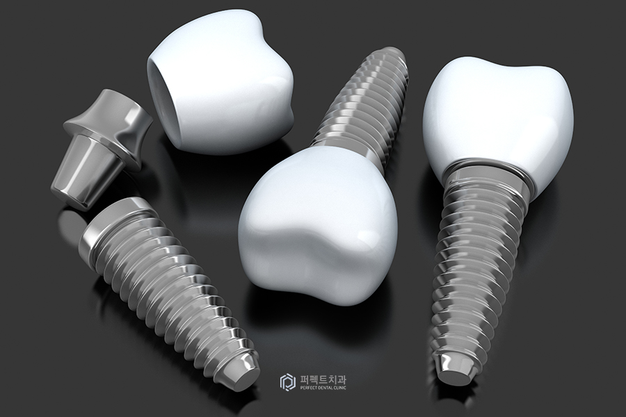 임플란트 보철 탈락①｜크라운이 빠지는 이유는? 관련 이미지 1