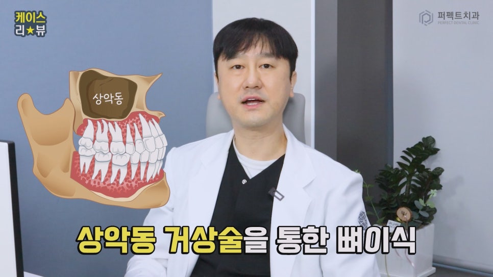 임플란트를 해야하는데 상악동에 염증이..😭 관련 이미지 7