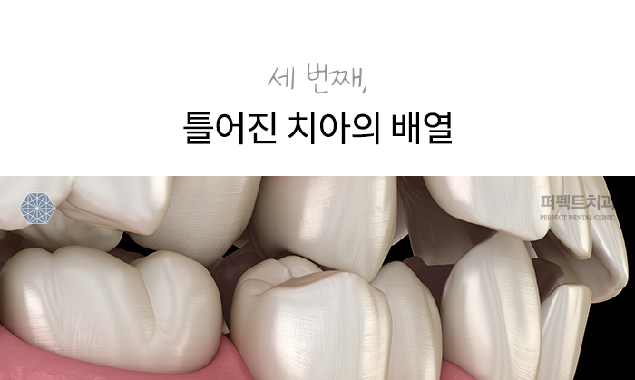 절대 무시하면 안 되는 치아증상 (치과치료꿀TIP!) 관련 이미지 5