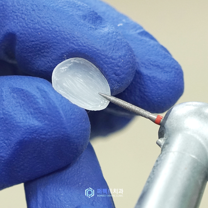 무삭제라미네이트도 단점이? 솔직한 장단점 알아보기! 관련 이미지 3