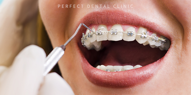 치아교정 후 재교정 방법은? 관련 이미지 2