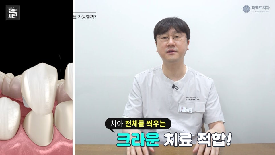 레진으로 치료받은 앞니도 라미네이트 가능한가요? 관련 이미지 4