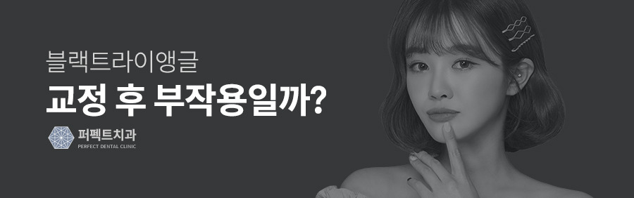 블랙트라이앵글, 치아교정의 부작용일까? 관련 이미지 2