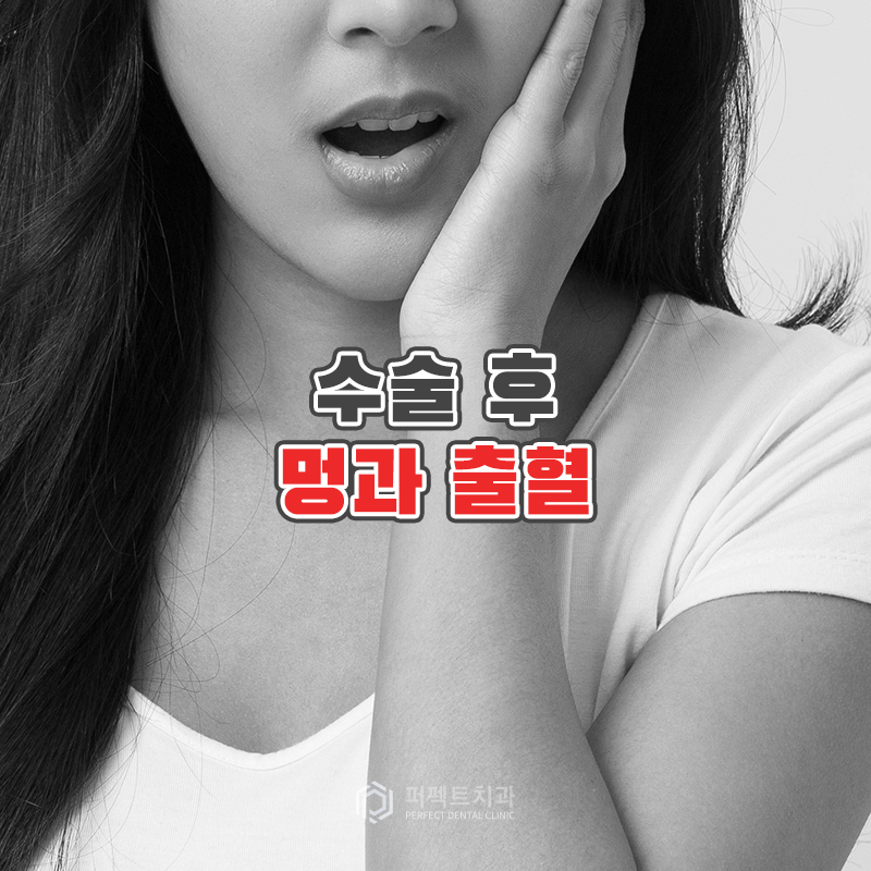 임플란트 수술 후 주의사항은? 관련 이미지 6