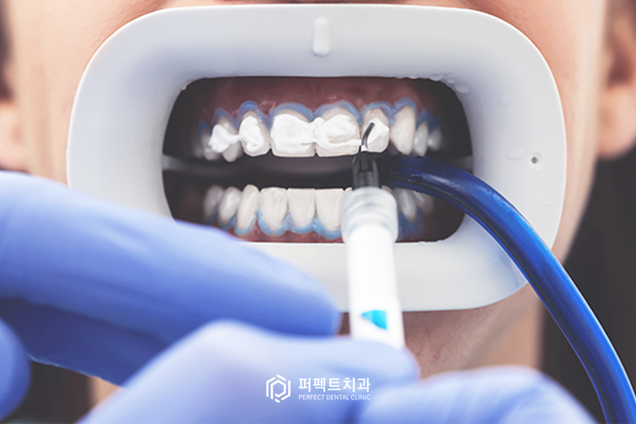 얼룩덜룩한 치아.. 미백으로 해결할 수 있나요? 관련 이미지 1