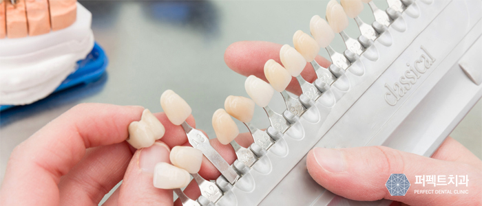 라미네이트와 치아성형 큰 차이점 관련 이미지 4
