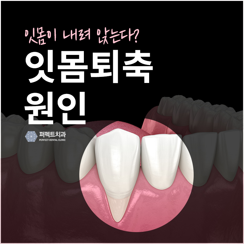 잇몸퇴축 원인과 문제점은? 관련 이미지 1