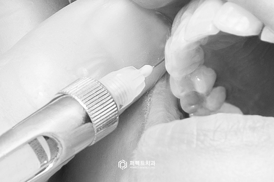 무통마취기는 통증이 하나도 없을까? 관련 이미지 3