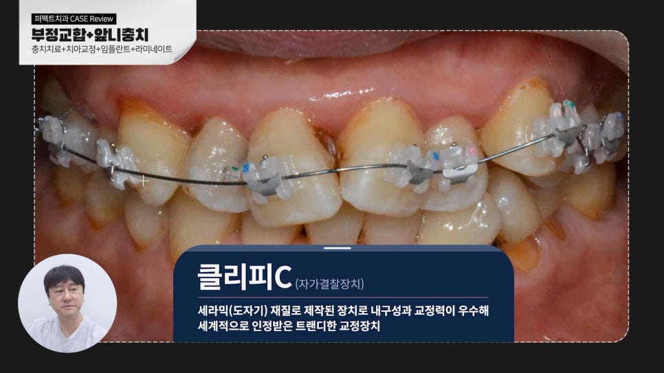 복합적인 치료가 필요한 케이스 리뷰 관련 이미지 4