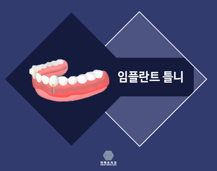 상실한 치아 찾고 싶은데 보철치료 종류에는? 관련 이미지 7