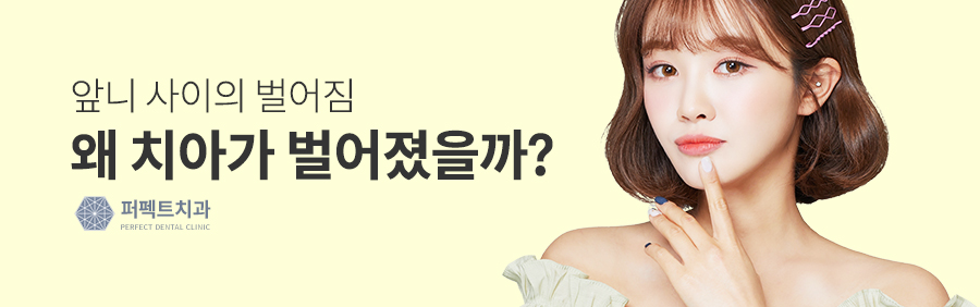 벌어진앞니교정, 원인부터 해결 방법까지 관련 이미지 2