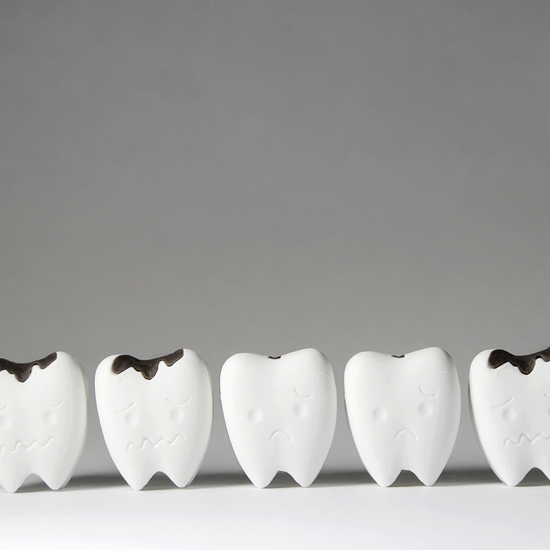 임플란트 한 치아에도 충치가 생길 수 있을까? 관련 이미지 2