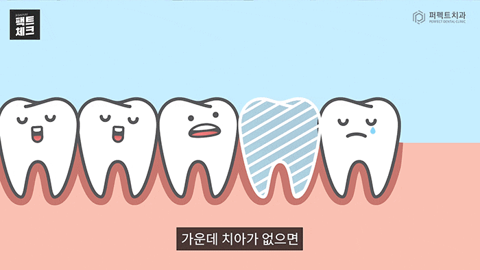 임플란트도 나이 제한이 있다?① - 학생편 관련 이미지 4