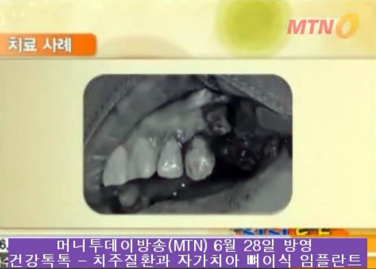 MTN 건강톡톡 방송장면^^ 관련 이미지 10