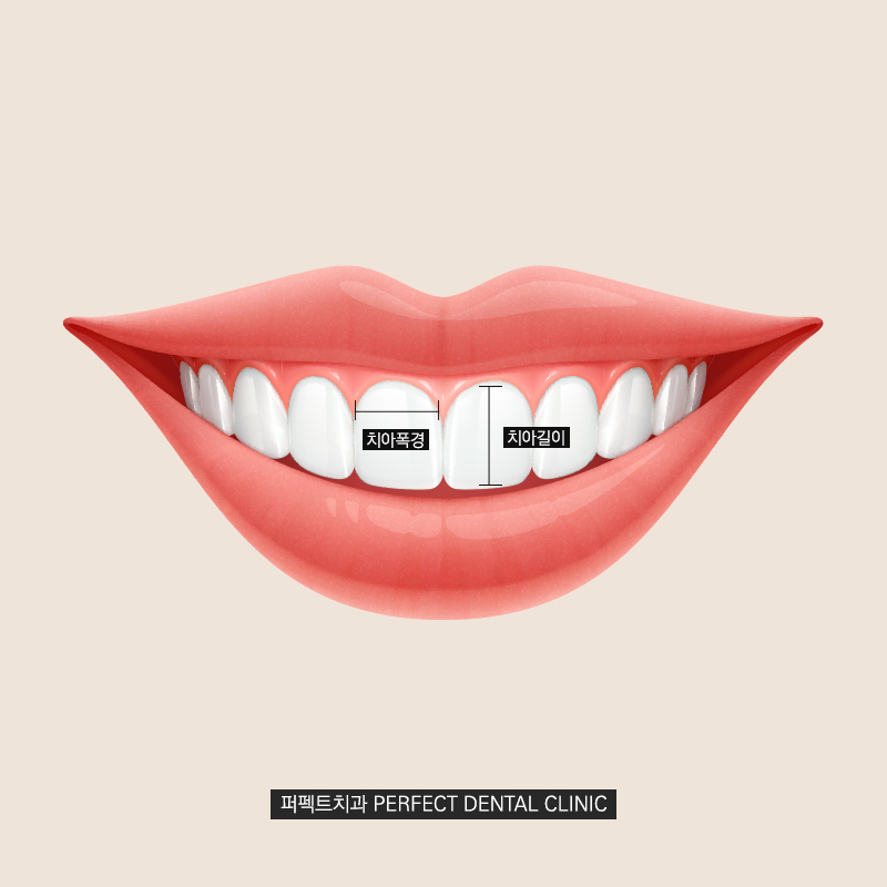 큰 치아도 라미네이트가 가능할까요? 관련 이미지 2