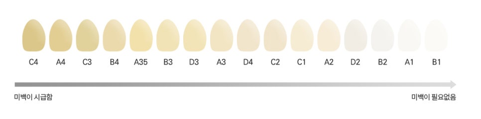 누런치아, 원인과 해결방법! 관련 이미지 4