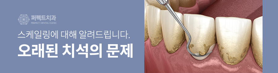 스케일링 아직 안받은 사람? 연 1회 건강보험 적용! 관련 이미지 4