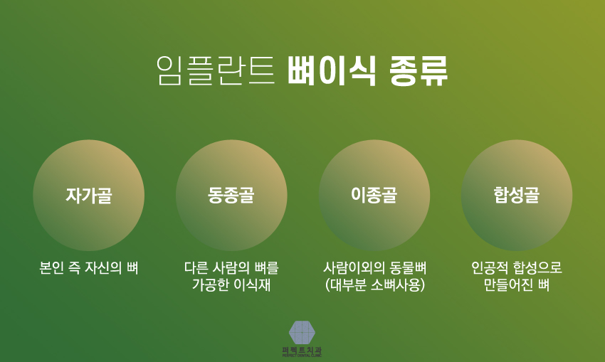 뼈이식임플란트란 뭘까? 관련 이미지 5