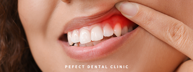 잇몸에 좋은 음식 알아보기! 관련 이미지 1