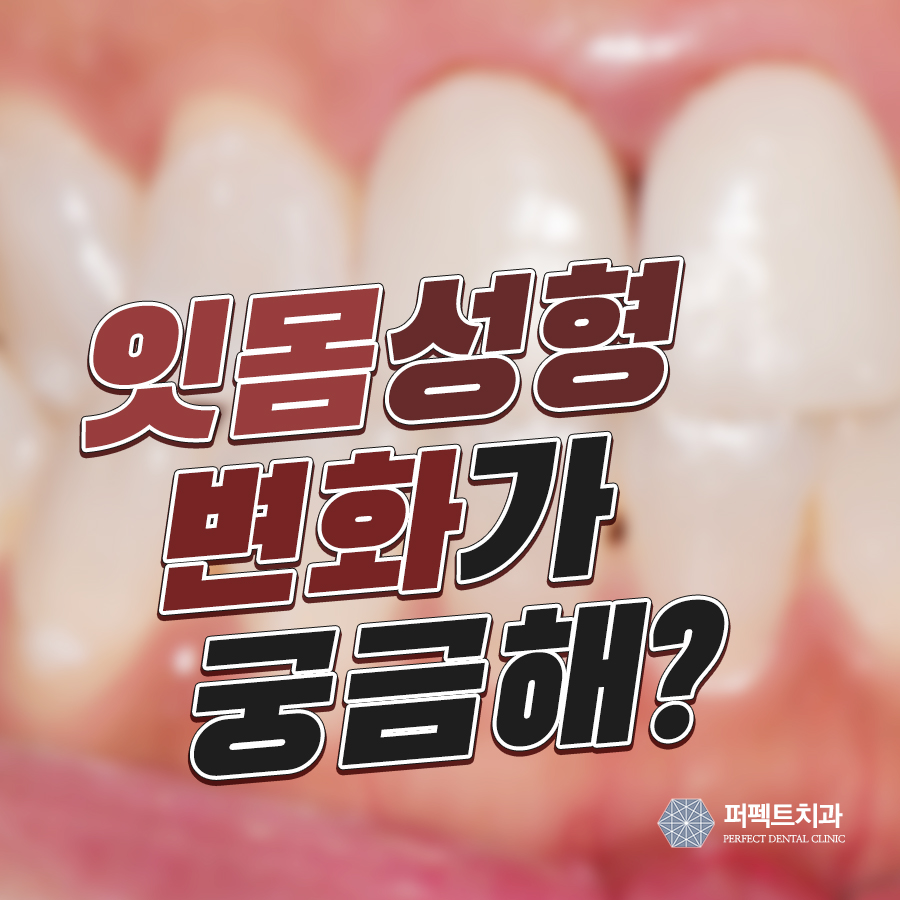 선릉 퍼펙트치과 잇몸성형 관련 이미지 1