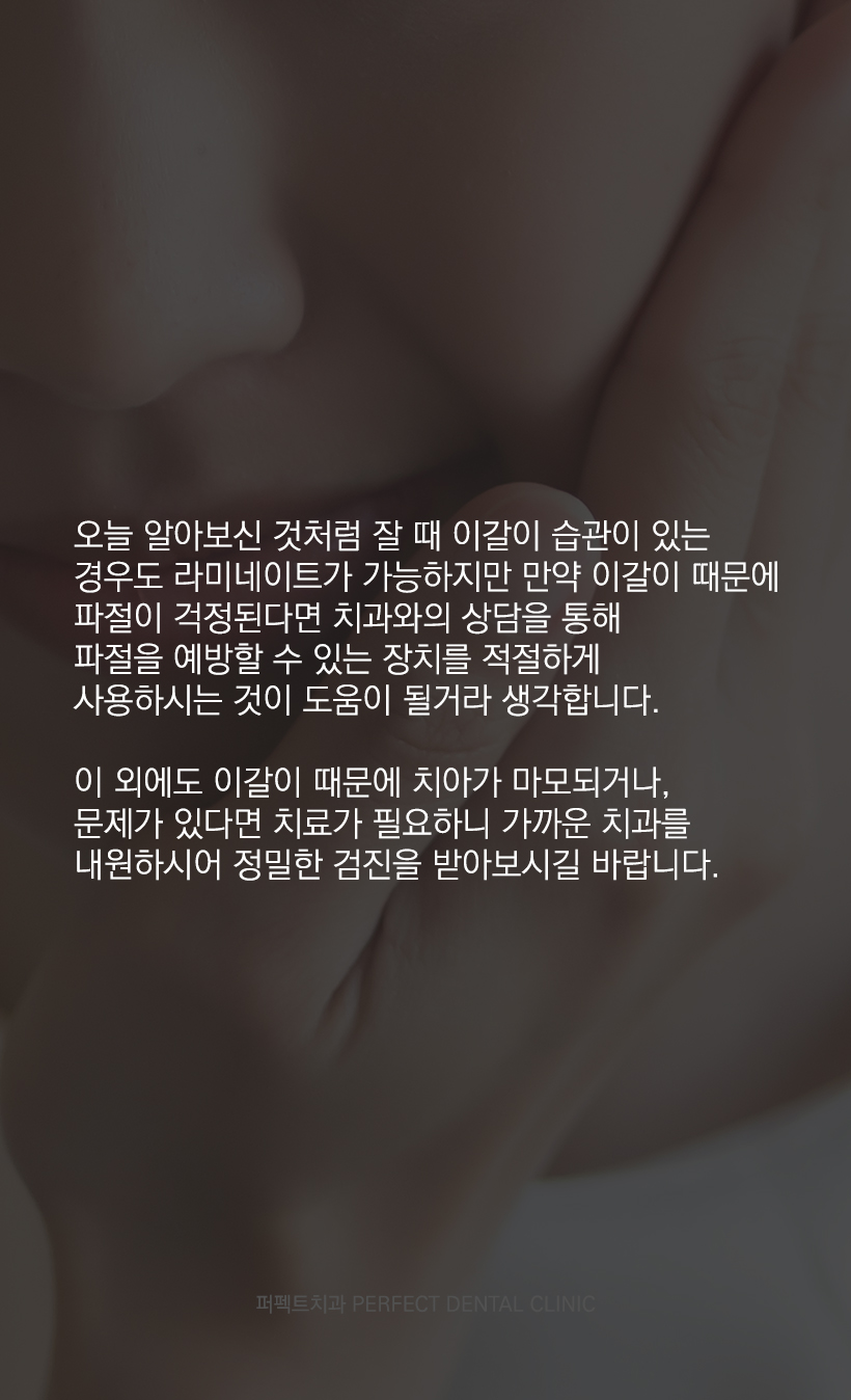 이갈이 하는데 라미네이트 가능한가요? 관련 이미지 6