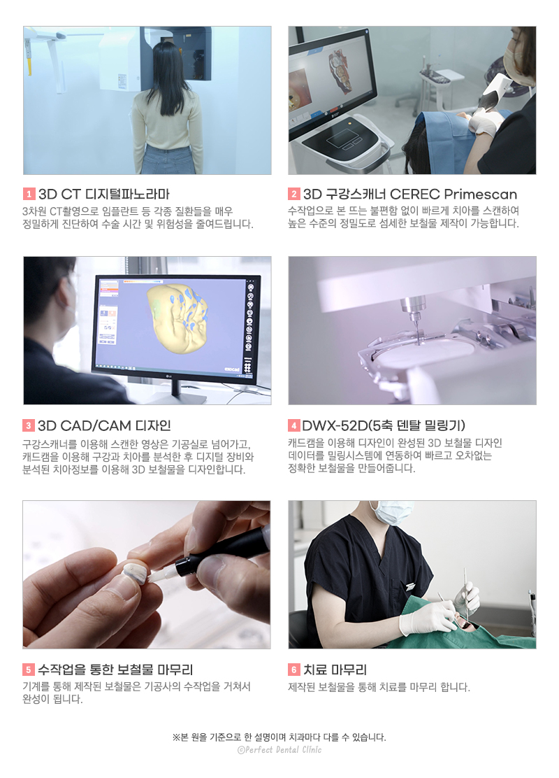 컴퓨터 분석을 통한 임플란트 관련 이미지 11